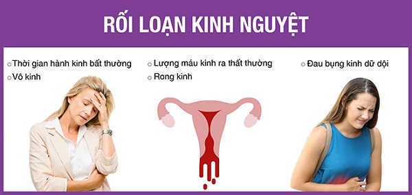 dấu hiệu nhận biết bị rối loạn kinh nguyệt