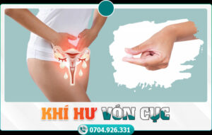 khí hư vón cục