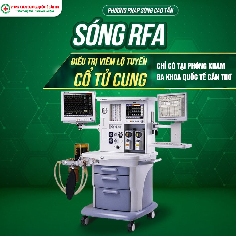 sóng rfa điều trị viêm lộ tuyến cổ tử cung